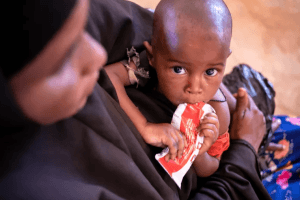 Somali children face worsening malnutrition as Middle East conflict disrupts aid supplies